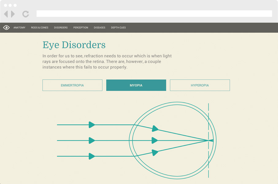 Eye Disorders
